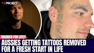 Aussies Getting Tattoos Removed For Free For A Fresh Start In Life [upl. by Kendall]