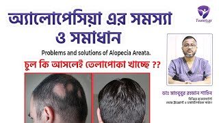 অ্যালোপেসিয়া এর সমস্যা ও সমাধান । । Problems and solutions of Alopecia Areata [upl. by Duffie747]