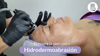 Prepara la piel para procedimientos estéticos con Hidrodermoabrasión 💧 [upl. by Jessabell]