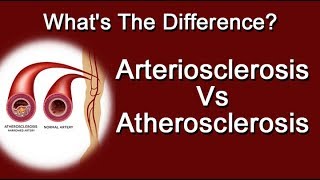 Arteriosclerosis Vs Atherosclerosis  Whats The Difference [upl. by Martita]