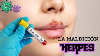 Herpes y cómo se propaga Tratamiento y prevención herpeszoster enfermedades síntomas [upl. by Arondel270]