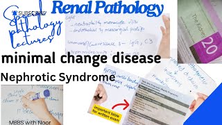 minimal change disease  nephrotic syndrome  renal pathology lectures  selflessmedicose [upl. by Clyve]