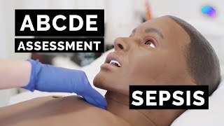 ABCDE Assessment  Sepsis  Emergency Simulation Scenario  OSCE Guide  UKMLA  CPSA [upl. by Nahsin]