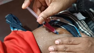 Must Watch Vitamin B1B6B12 Buttock Injection Video Ep 35 Injection Vision [upl. by Zared237]