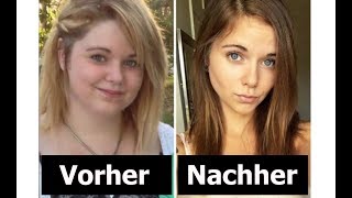 Vorher Nachher Abnehmen Bilder  UNGLAUBLICHE Gesichtstransformationen  MOTIVATION PUR [upl. by Nerral893]