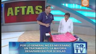 Doctor TV Sepa diferenciar un afta del cáncer 140813 [upl. by Glanti712]