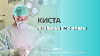 Эндоскопическая фенестрация кисты пинеальной железы [upl. by Bergman]