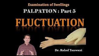 Palpation of Swellings  Part 5  Fluctuation [upl. by Rubi]