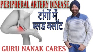 PERIPHERAL ARTERY DISEASE  टांगों में ब्लड क्लॉट  दर्द सुन्नपन और जकड़न  Top Homeopathic Remedies [upl. by Nosemyaj]