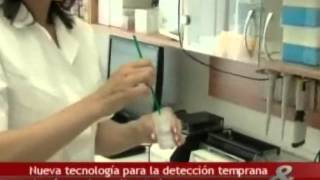 Citología en base liquida  CMamp Internacional  Fundación Universitaria Ciencias de la Salud [upl. by Hearn]