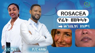 Rosacea የፊት መቅላትመንስኤ ና ህክምና  Dr Feysel Alo [upl. by Gideon]