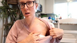 Breast Surgery Recovery [upl. by Corrina989]