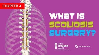 Ch 4  What is Scoliosis Surgery [upl. by Nodnahs]