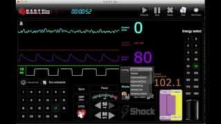 ECG Simulator  EKG Rhythm Simulator [upl. by Lletnahc]