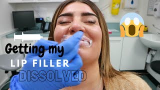 GETTING MY LIP FILLERS DISSOLVED  HYALURONIDASE  CAITLYN HOWITT [upl. by Anirbas]