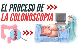 Todo lo que Debes Saber sobre la Colonoscopia y Salud del Colon [upl. by Ire]