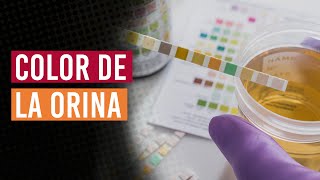 ¿Cuál es el color de tu orina ¿Qué significa [upl. by Eitsyrhc561]