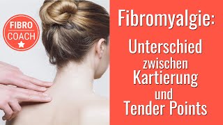 Fibromyalgie Was ist eine Kartierung und ist das was anderes als Tender Points [upl. by Aisa]