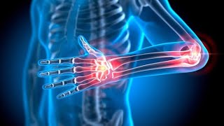 5 Ms of Rheumatology  RahulL மைய முடக்குயியல் துறையில் வளமேலாண்மை  ராகுல்L [upl. by Elaweda]