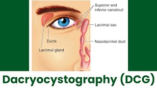 What is DCG Test When Is A Dacryocystography Performed Role Of DCG Nasolacrimal Duct Obstruction [upl. by Anis]