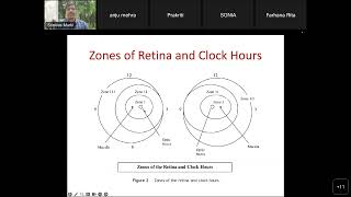 Retinopathy of Prematurity ROP [upl. by Starbuck]