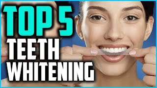 Best Teeth Whitening Strips In 2024 Professional Whitestrips Kits [upl. by Hannis]