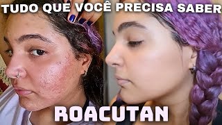 COMO É TOMAR ROACUTAN antes e depois efeitos colaterais dicas evolução e contraindicações ✨️ [upl. by Aikemot984]