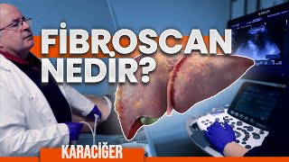 FİBROSCAN NEDİR NEDEN YAPILIR  Karaciğer ölçümü Prof Dr Yusuf AKCAN [upl. by Nilreb]