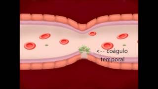 REPASO II  HEMATOLOGÍA [upl. by Bourn113]