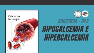 Hipocalcemia e Hipercalcemia [upl. by Ereynihc387]