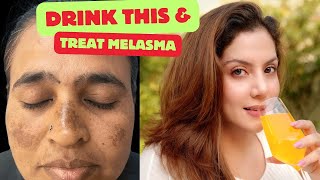 Drink this to treat Melasma amp Pigmentation  Nipun Kapur [upl. by Mccallum39]