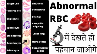 RBC Anomalies  RBC Abnormal Morphology  Inclusion bodies under microscope 🔬 [upl. by Vally]