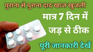 Dad Ki Dawa  सिर्फ 7 दिन में दाद खाज खुजली जड़ से ठीक  Terbicad 250 Tablet  dad ki dawai [upl. by Stubbs]