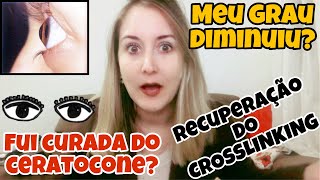 CERATOCONE  DOENÇA GRAVE NOS OLHOS RECUPERAÇÃO CROSSLINKING  Bianca Peres [upl. by Dera]