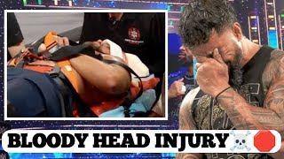 Shocking Incident🛑 Jey Usos Spear Attack on Bron Breakker leaving him with a horrible head injury [upl. by Airak]