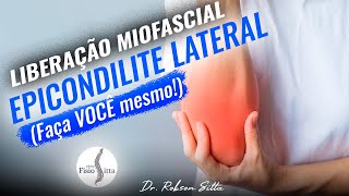 LIBERAÇÃO MIOFASCIAL EPICONDILITE LATERAL do COTOVELO FISIOTERAPIA MANUAL Clínica Dr Robson Sitta ® [upl. by Ainesy]