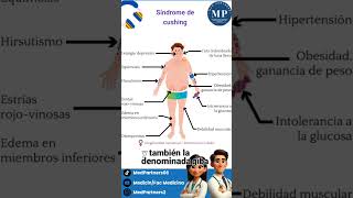 Síntomas y signos del Síndrome de Cushing shorts medicinahumana [upl. by Reta]