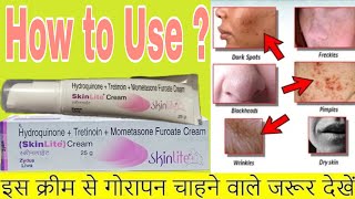 Skinlite cream review  how to use skinlite cream  fairness cream skin Lite [upl. by Gahl]