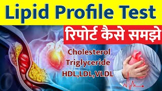 Lipid profile test in Hindi I Lipid profile Test Report कैसे समझे I [upl. by Elish]