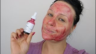 The Ordinary AHA 30  BHA 2 Peeling Solution Review amp Demo [upl. by Ahseetal]