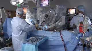 Laparoscopic vs Robotic [upl. by Couq]