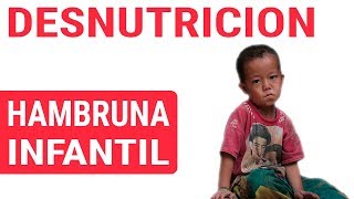 😢 Desnutrición infantil Causas incidencias y factores de riesgos [upl. by Kilk]