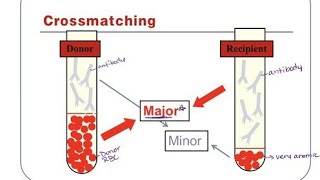 Cross match test Complete procedure Step By Step major and minor [upl. by Htebsle]