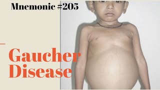 Gauchers Disease Mnemonic for USMLE Step 1 [upl. by Acenes]