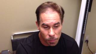 Joses Bosley Hair Transplant Review  2 weeks PostProcedure [upl. by Liddy496]