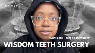 GETTING MY WISDOM TEETH REMOVED 🦷  vlog  post op treatment and tips [upl. by Ariek]