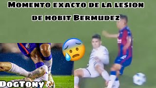 Lesión de quotHobbitquot Bermúdez hoy en el partido Atlante vs Dorados momento exacto [upl. by Amerak935]