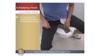 ColostomyIleostomy Emptying a Pouch [upl. by Annaoy]