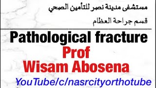 Pathological fractures Prof Wisam Abosena Nasrcity online lectures 2020 [upl. by Gaskill573]