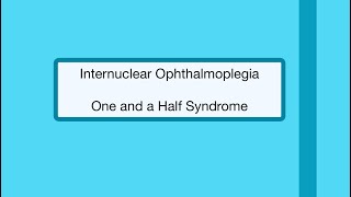 Internuclear Ophthalmoplegia  One and a Half Syndrome 👁 [upl. by Marge]